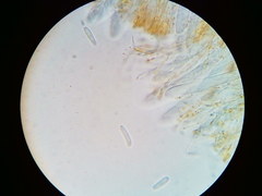 Arachnopeziza trabinelloides