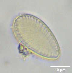 Surirella