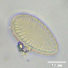 Surirella