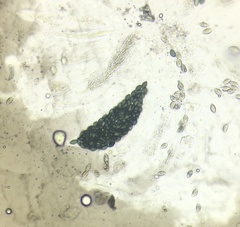 Podospora collapsa