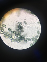 Podospora collapsa