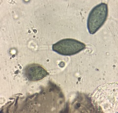 Podospora collapsa