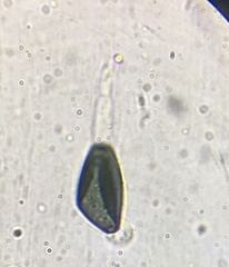 Podospora collapsa