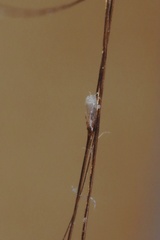 Pediculus humanus capitis