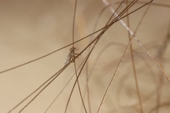Pediculus humanus capitis