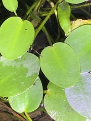Hydrometra