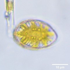 Surirella