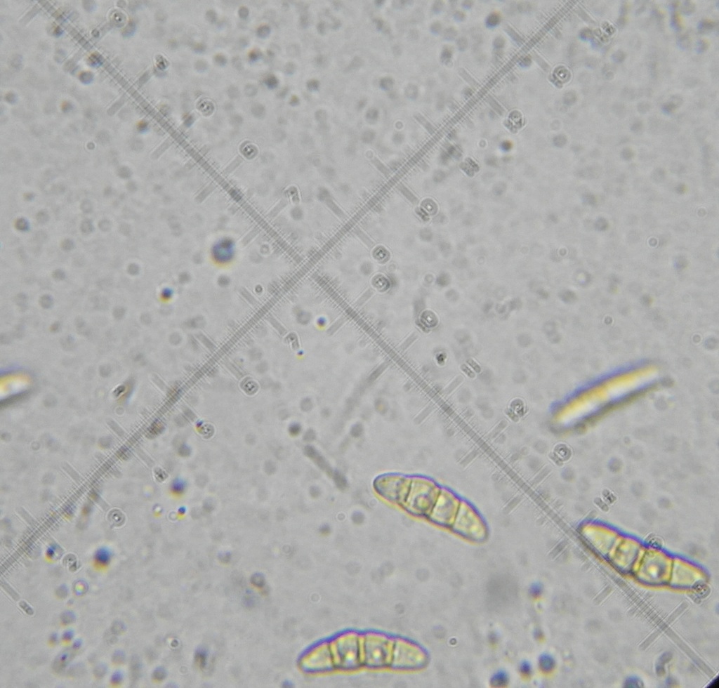 Phaeosphaeria culmorum