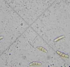 Phaeosphaeria culmorum