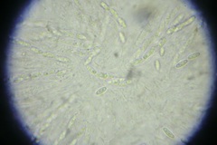 Phomatospora berkeleyi