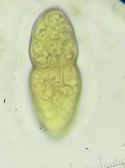 Pleomassaria carpini