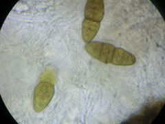 Pleomassaria carpini