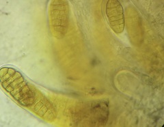 Stemphylium vesicarium