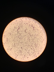 Staphylococcus aureus
