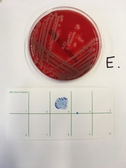 Staphylococcus aureus
