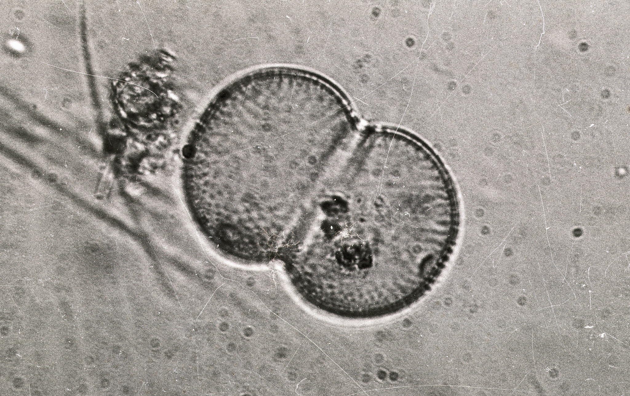 Cosmarium connatum