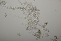 Peronospora alsinearum