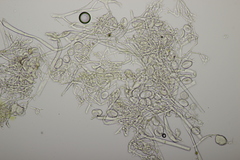 Peronospora alsinearum