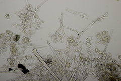 Peronospora alsinearum