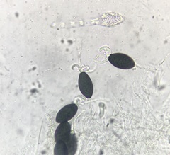 Podospora pleiospora