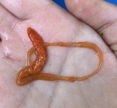 Tubulanus