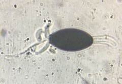 Podospora pleiospora