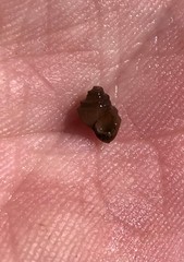 Campeloma decampi