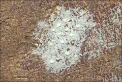 Pertusaria pertractata