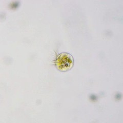 Strobilidium