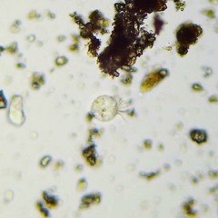 Strobilidium
