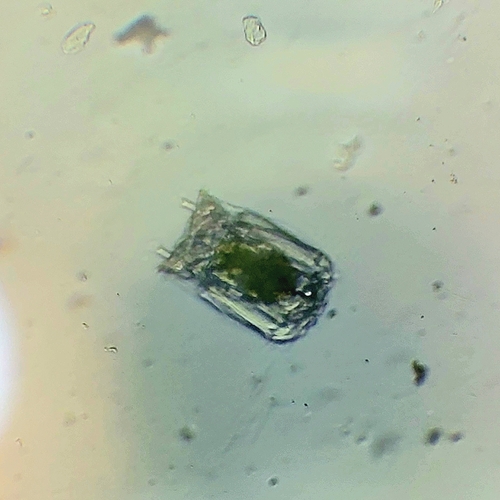 Polyarthra vulgaris