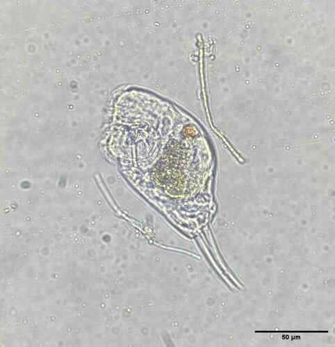 Cephalodella gibba
