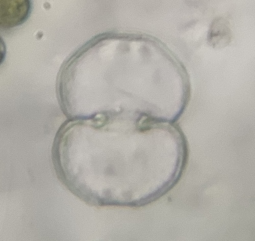 Cosmarium mamilliferum