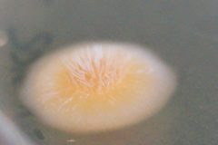 Colletotrichum