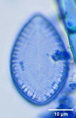 Surirella brebissonii