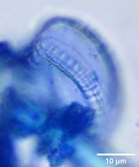 Surirella brebissonii