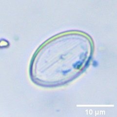Cocconeis