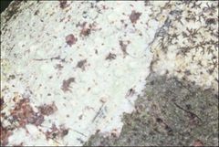 Pertusaria pertractata