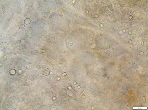 Common Hydra