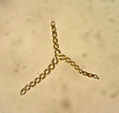 Fossombronia hispidissima