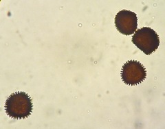 Fossombronia hispidissima