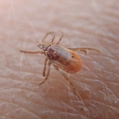 Ixodes ricinus