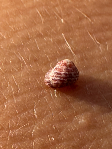 Collonista, 2026-05-25
