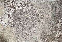 Lecanora pseudistera