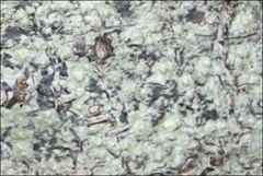 Pertusaria pertractata