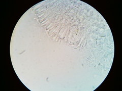 Orbilia crenatomarginata