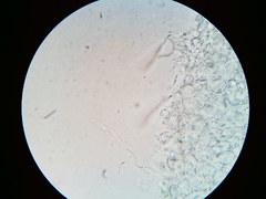 Orbilia crenatomarginata