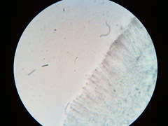 Orbilia crenatomarginata