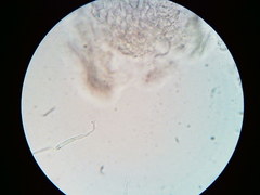 Orbilia crenatomarginata