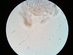 Orbilia crenatomarginata